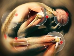 Image of the differents possible parts of the body toutched by chronic pain