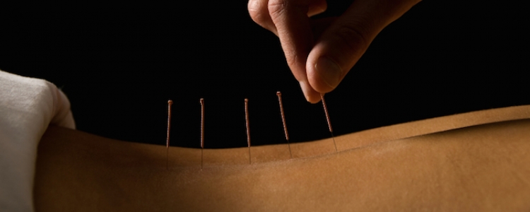 acupuncture can cure backache