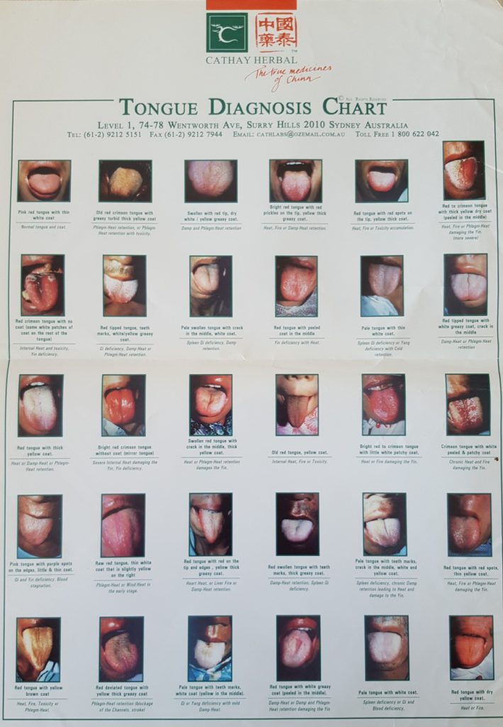 Tongue chart with photos showing how the tongue looks for various conditions.