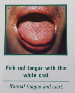 Picture of a normal tongue from acupuncturist's chart : pink red tongue with thin white coat